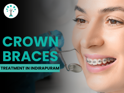 Crown Braces in Indirapuram