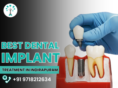 Dental Implant in Indirapuram