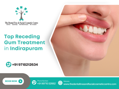 Receding Gums Treatment in Indirapuram